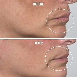 Ultra Repair - Firming Collagen Cream